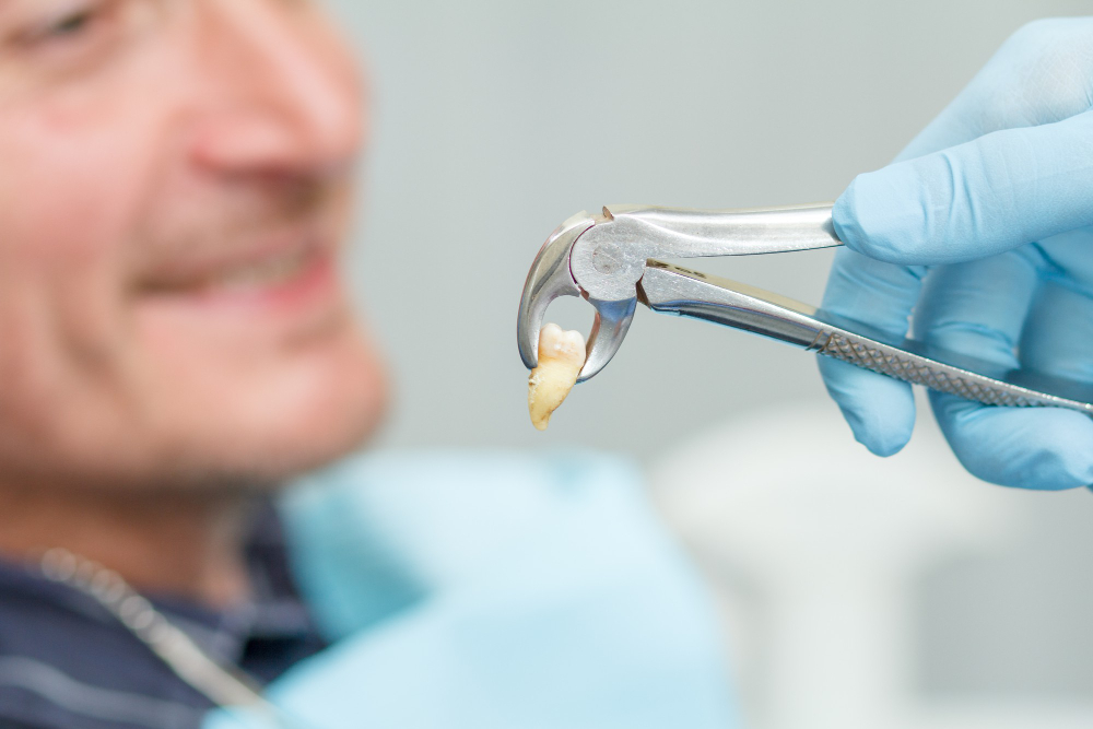Dental Extraction in Dahisar West