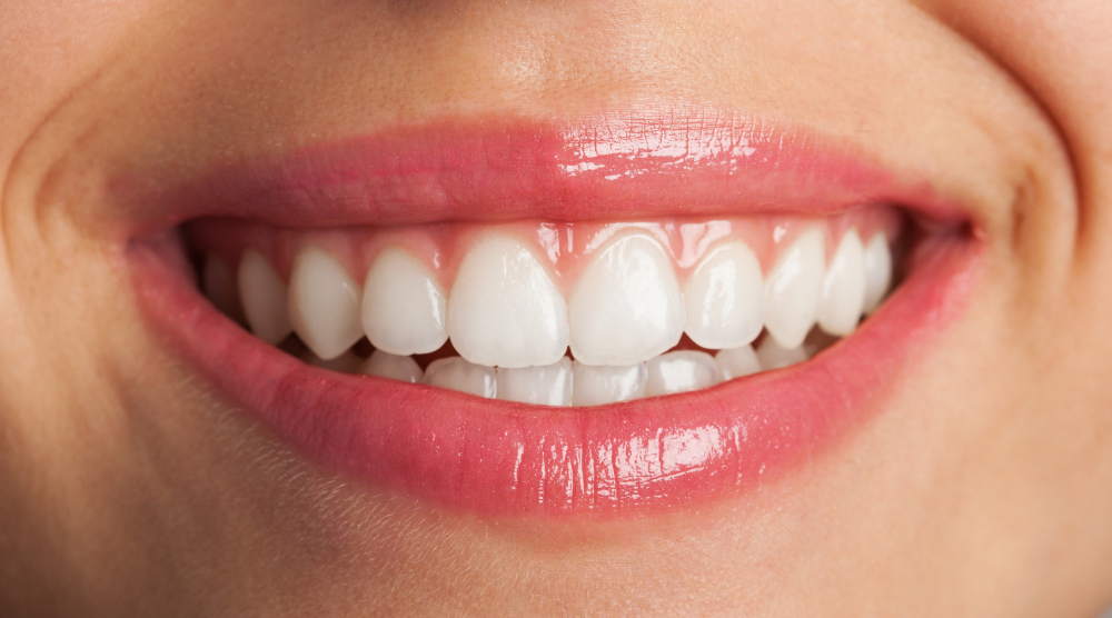 Teeth Whitening Near Me